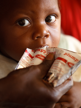 UNICEF-Malnutrition